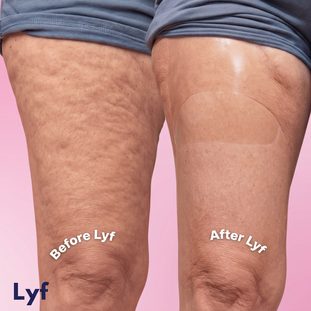 Lyf Legs