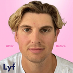 Lyf Ears
