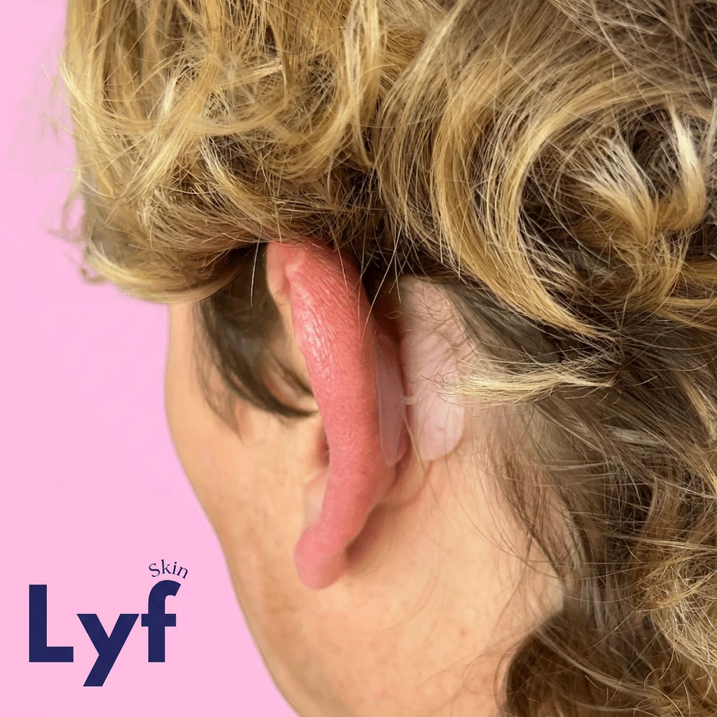 Lyf Ears