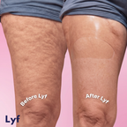 Lyf Legs
