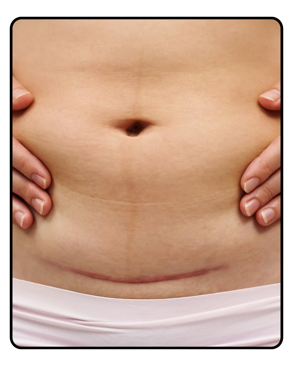 Lyf Tummy