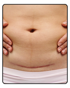 Lyf Tummy
